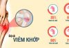 benh viem khop trieu chung va dieu tri